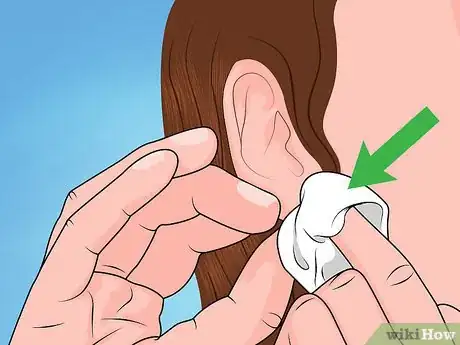 Image titled Reopen a Partially Closed Ear Piercing Hole Step 1