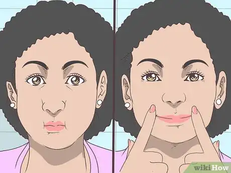 Image titled Get Rid of Nasolabial Folds Fast Step 15