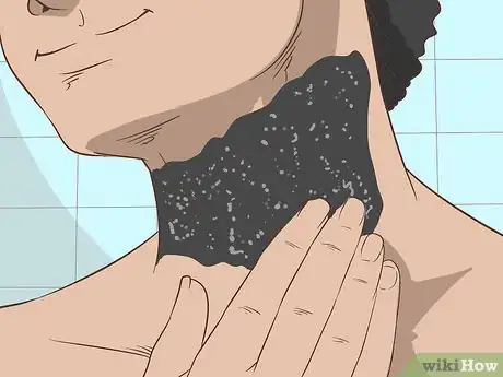 Image titled Prevent Ingrown Hairs on Your Neck Step 10