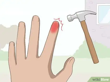 Image titled Reduce Swollen Fingers Step 2