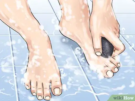 Image titled Clean Toe Nails Step 2