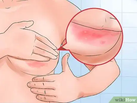 Image titled Prevent Mastitis Step 12