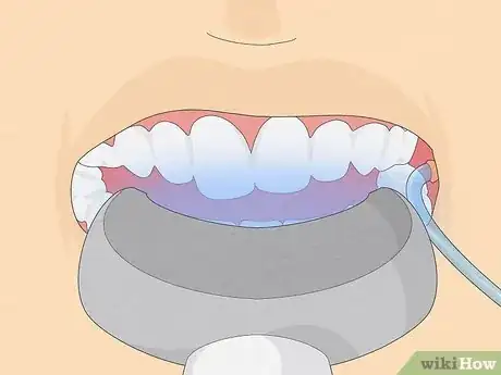 Image titled Have White Clean Shiny Teeth Step 8