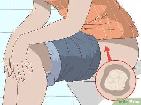 Image titled Reduce Vaginal Discharge Step 14