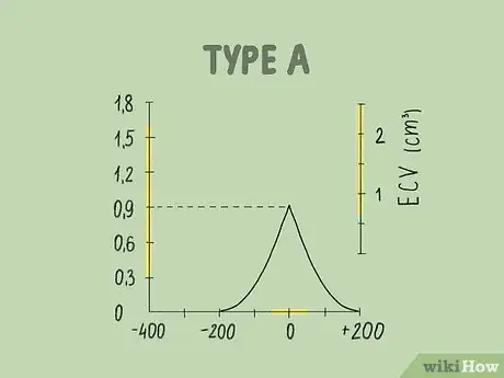 Image titled Read a Tympanogram Step 6