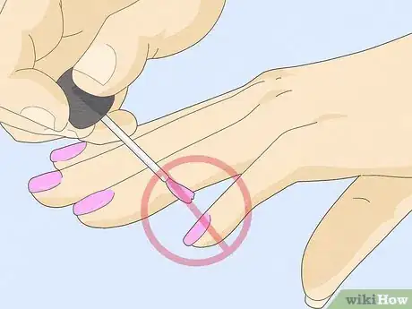 Image titled Get Rid of White Spots on Your Nails Step 12