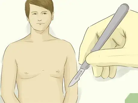 Image titled Treat Gynecomastia Step 8