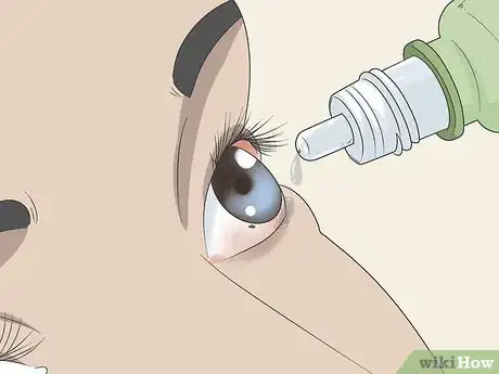 Image titled Get Sand Out of Your Eyes Step 4