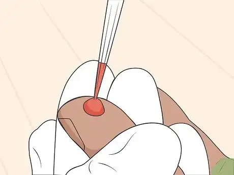 Image titled Perform an HIV Test at Home Step 15