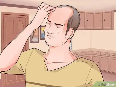 Image titled Adjust to Hair Loss and Baldness Step 3