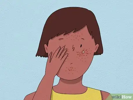 Image titled Recognize an Allergic Reaction Step 17