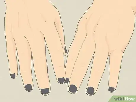 Image titled Stop Biting Your Nails Step 15