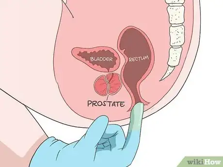 Image titled Locate Your Prostate Step 7