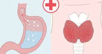 Dissolve Nodules Naturally