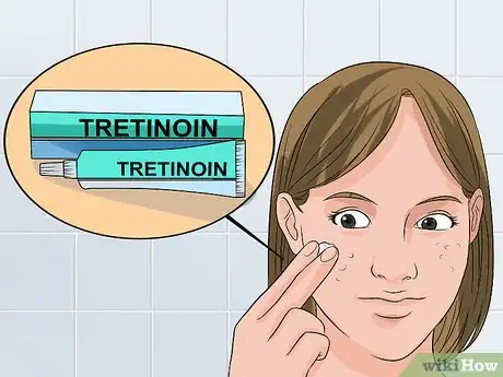 Image titled Use Tretinoin and Benzoyl Peroxide Concurrently Step 12