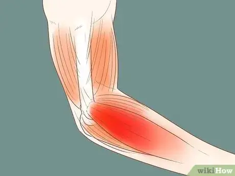 Image titled Heal a Sore Arm Step 1