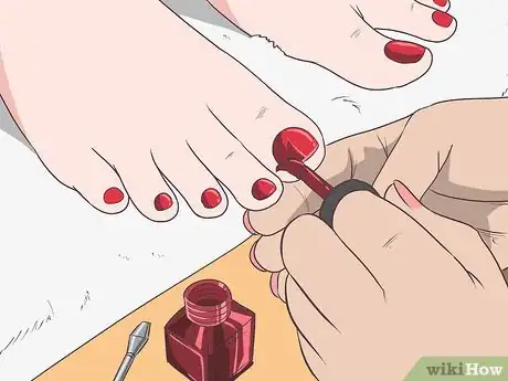 Image titled Get Rid of Psoriasis on Your Nails Step 15