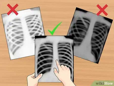 Image titled Read a Chest X Ray Step 5