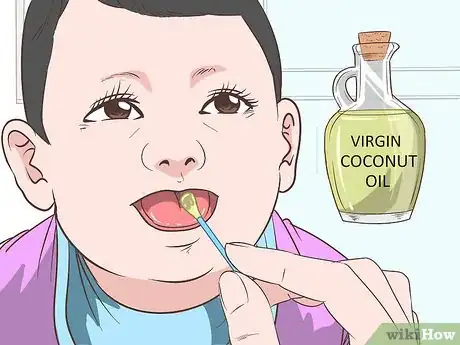 Image titled Get Rid of Thrush in Infants Step 5