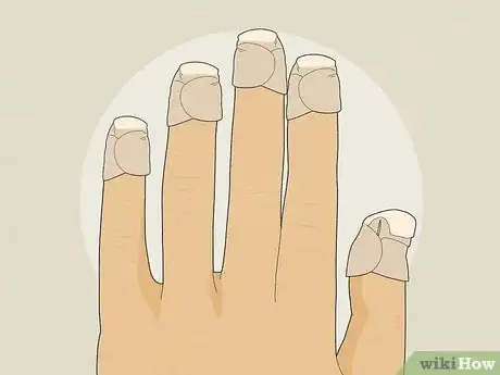 Image titled Stop Biting Your Nails Step 23