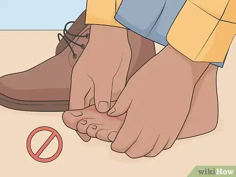 Image titled Get Rid of Foot Fungus at Home Step 13