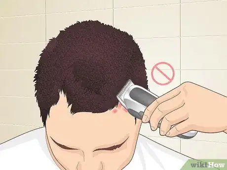 Image titled Bumps on Scalp Step 10