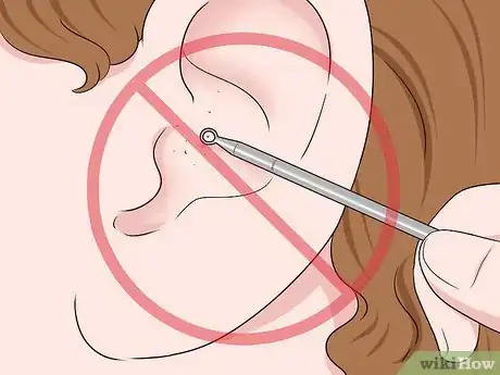 Image titled Get Blackheads Out of Your Ear Step 4