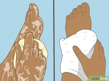 Image titled Make Your Feet Smell Good Step 12