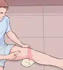 Cure a Baker's Cyst