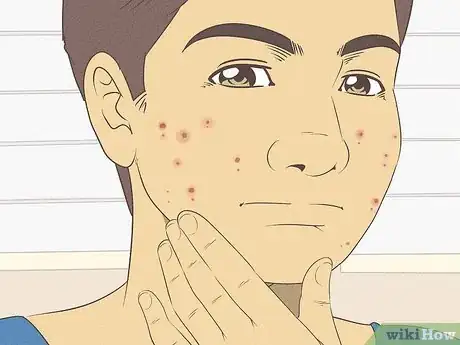 Image titled Wash Your Face when You Have a Sensitive Skin Step 1