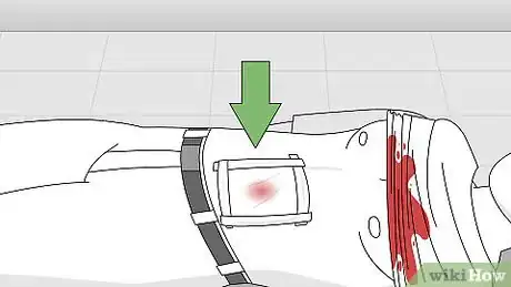 Image titled Attend to a Stab Wound Step 11