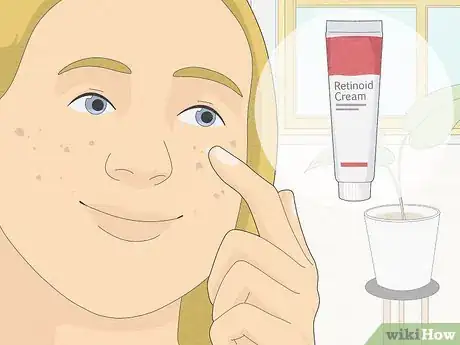 Image titled Improve Your Facial Skin Step 6