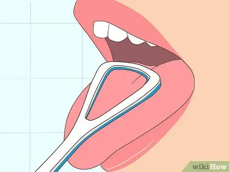 Image titled Use a Tongue Scraper Step 3