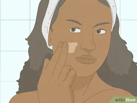 Image titled Get Rid of Dark Spots from Acne Step 3