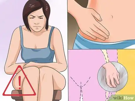 Image titled Treat a Yeast Infection Step 1