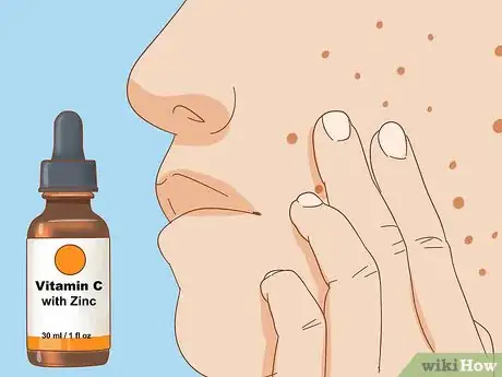 Image titled Apply Vitamin C Serum for Facial Skin Care Step 7