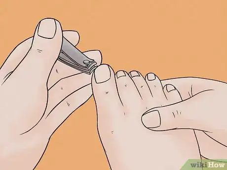 Image titled Get Rid of Dead Skin Step 12