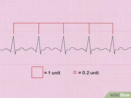 Image titled Calculate Heart Rate from ECG Step 3