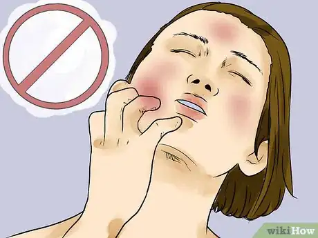 Image titled Prevent Skin Peeling After Sunburn Step 12