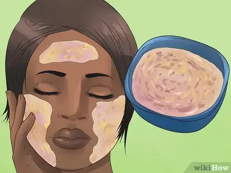 Image titled Remove Blackheads Step 4