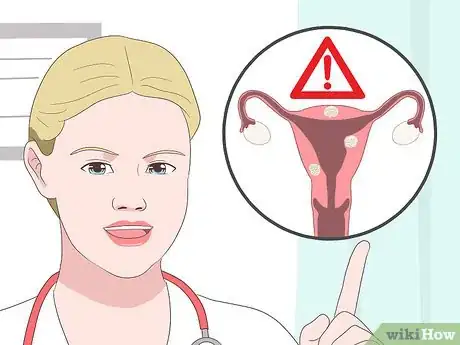 Image titled Deal with Fibroids During Pregnancy Step 6