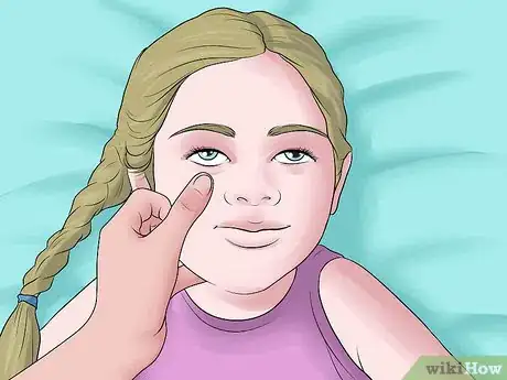 Image titled Easily Give Eyedrops to a Baby or Child Step 18