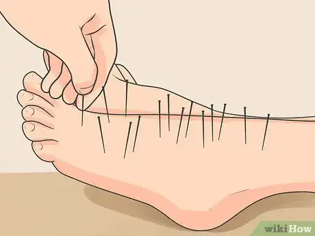 Image titled Treat Neuropathy in Feet Step 5