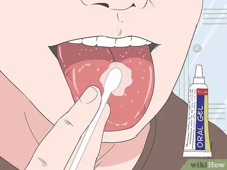 Image titled Heal Your Tongue After Eating Sour Candy Step 3