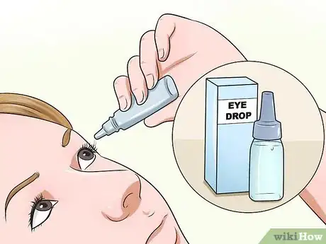 Image titled Treat Pink Eye (Conjunctivitis) Step 12