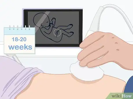 Image titled Tell a Baby's Gender from an Ultrasound Step 3