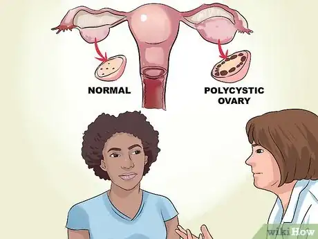 Image titled Recognize the Symptoms of Polycystic Ovary Syndrome Step 5