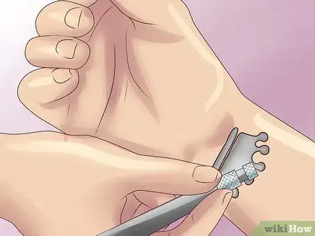 Image titled Remove a Tattoo at Home With Salt Step 6