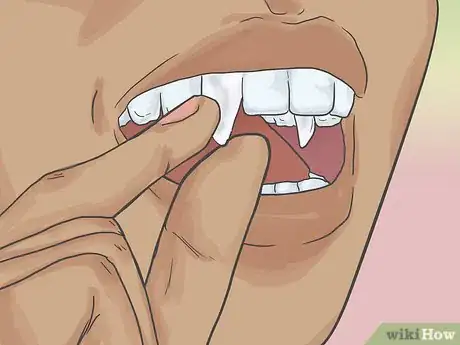 Image titled Apply Vampire Fangs Without Glue Step 5