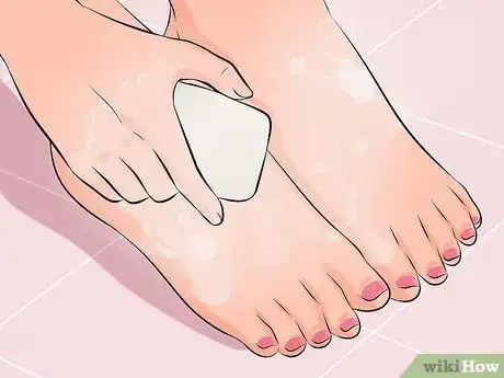 Image titled Make Your Feet Beautiful Step 22